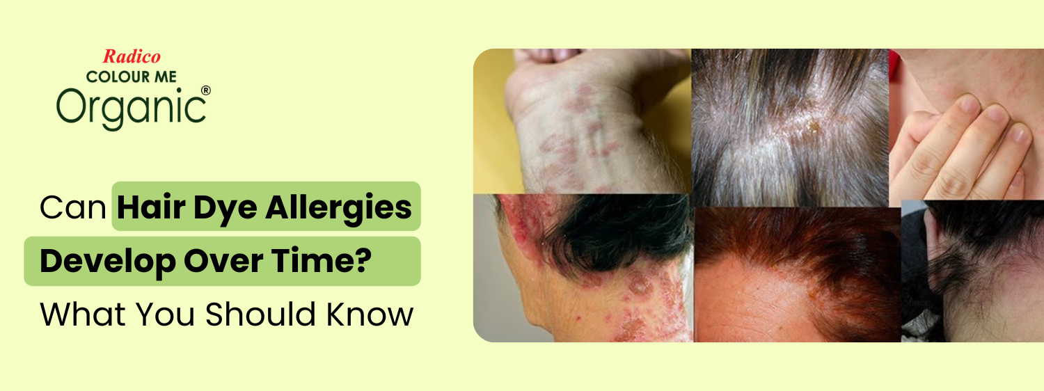 Can Hair Dye Allergies Develop Over Time? What You Should Know